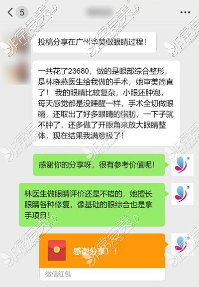 广州华美整形林晓燕做眼睛真实反馈