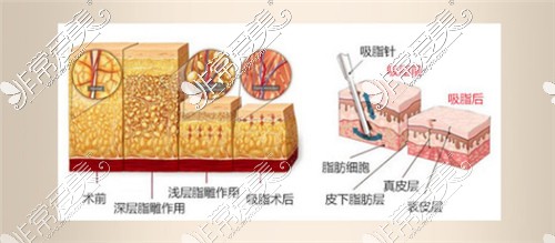 皮膚層次展示