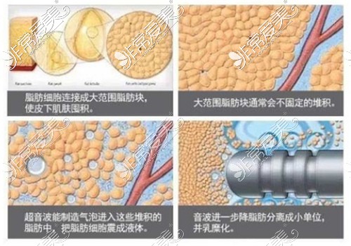 威塑吸脂原理图