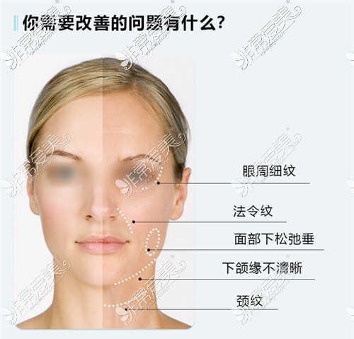 面部不同部位的肌肤问题