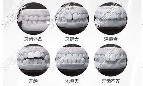 牙齿不齐的各种现象