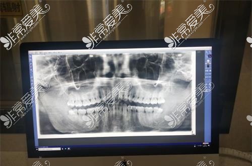 扬州贝恩口腔医院拍片