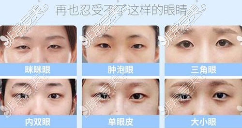 广州广大医院可以做哪些眼睛修复