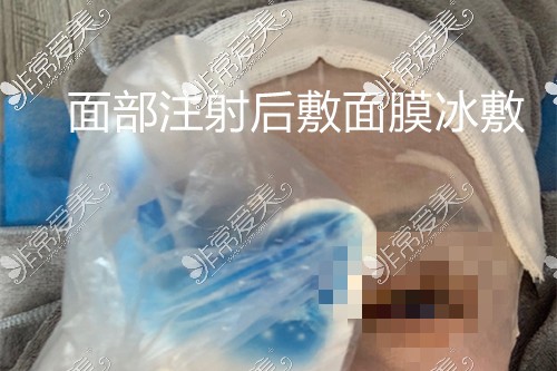 韩艺来美白除皱抗衰体验后冰敷护理