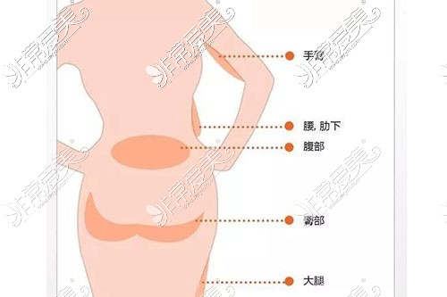 昆明哪个医院抽脂手术做的好？有做全身抽脂不错的医院吗