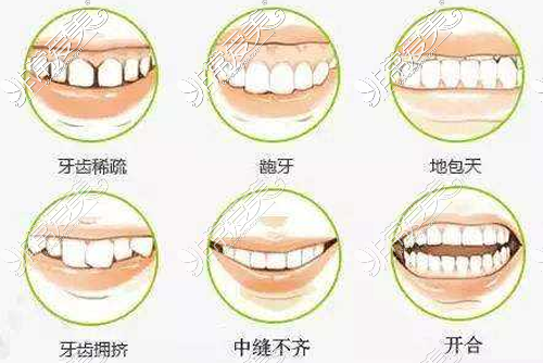 牙齒矯正