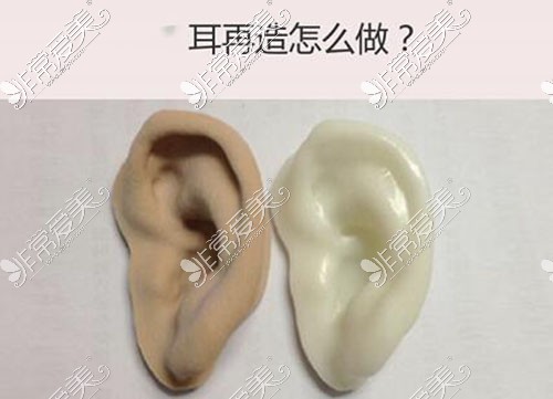 耳朵手术整形模型照片