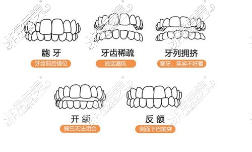 適合矯正的牙齒