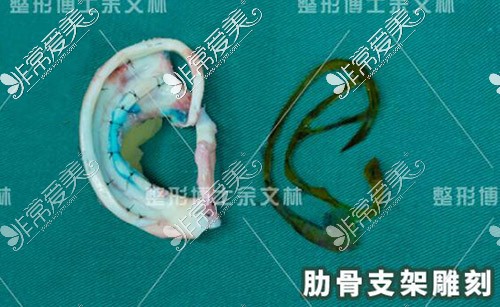 耳再造手術(shù)肋骨雕刻支架展示