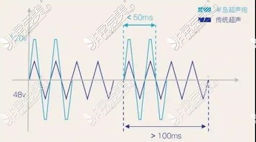超声炮和传统超声脉冲对比