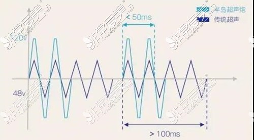 超聲炮和傳統(tǒng)超聲脈沖對比