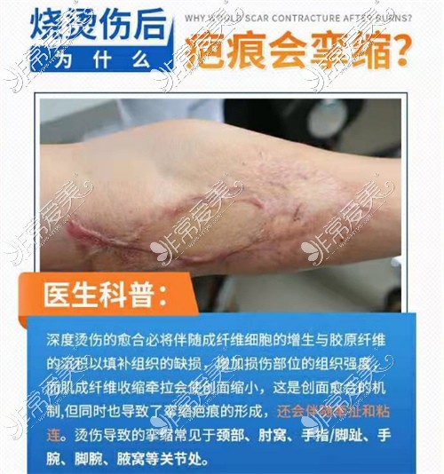 上海健桥医院疤痕介绍