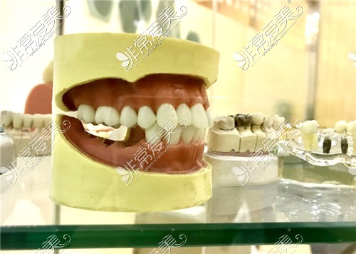 上海雅悦齿科牙齿模型