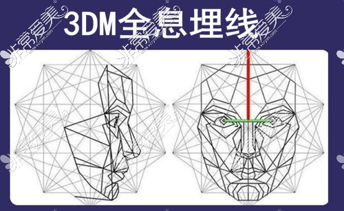 长沙希美整形3DM埋线