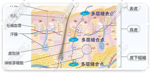 北京好年華醫(yī)療美容縫合和技術(shù)介紹