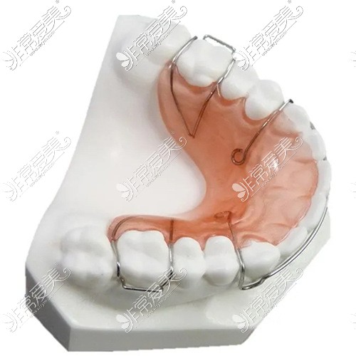 牙齿保持器——哈雷保持器