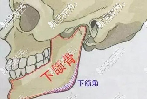 下颌角整形材料骨骼示意图