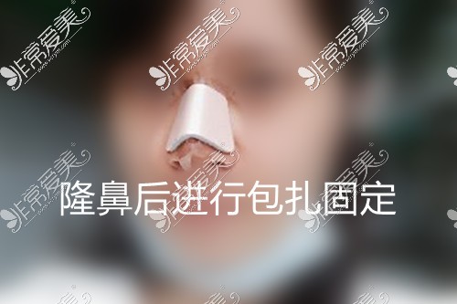 隆鼻后每天必须平躺么？女子深夜惊醒苦恼自己不会睡觉了