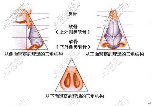 鼻翼缩小示意图