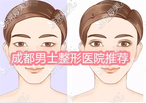 成都男士整形醫(yī)院排名公布