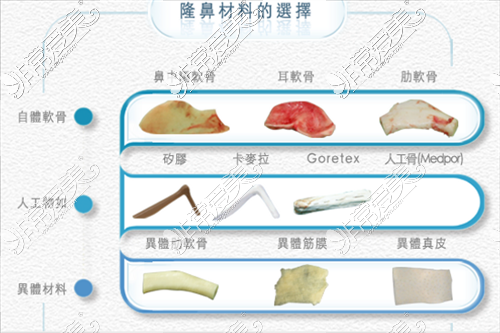 隆鼻材料示意圖