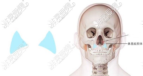 鼻基底填充位置介绍