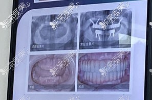 福州海峡口腔医院正规吗?是否可以使用医保就诊?