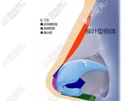 半肋骨鼻方法示意圖