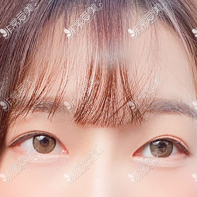 韩国yellow双眼皮图片