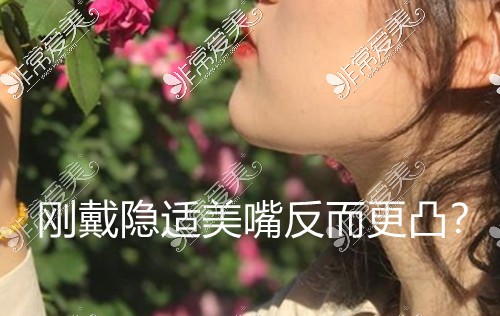 刚戴隐适美嘴反而更凸？隐适美多久会有明显变化？