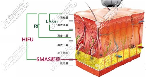 北京加减美哪个教授做提升好?不同医生做提升都有什么差别?