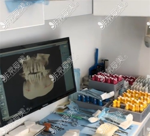 种植牙手术准备