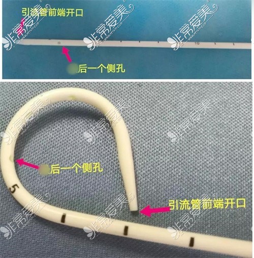 胸部留置引流管图片