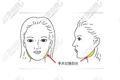 医生传授4种公认有效的瘦脸方法，第四个亲测有效