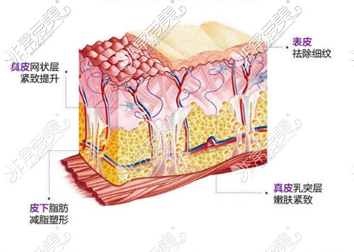 fotona4d欧洲之星功效图示