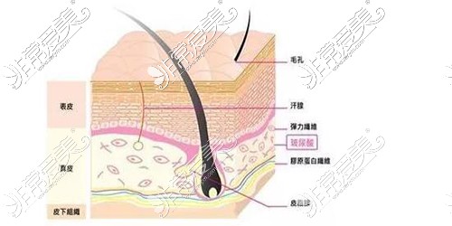 玻尿酸注射圖解