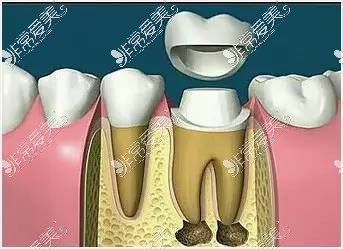 根冠的作用图片