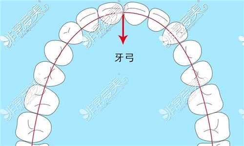 牙弓形态分几种图片图片