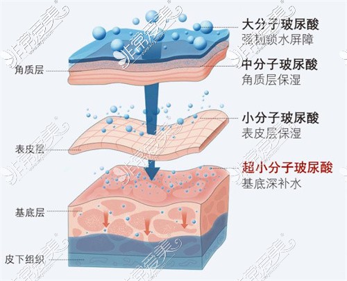 瑞蓝与乔雅登的区别都是啥?从原理价格到适用人群全面分析!