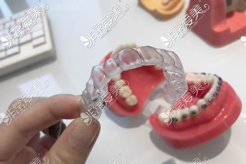 牙齿矫正牙套模具展示