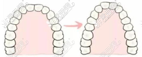 牙弓示意图