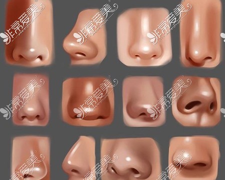 各种不同形状的鼻子