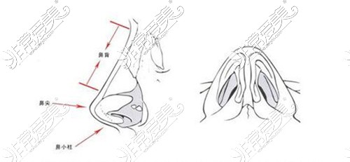 假体隆鼻卡通图展示
