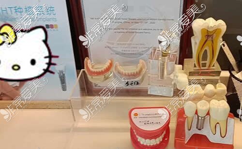 口腔医院牙齿模型展示