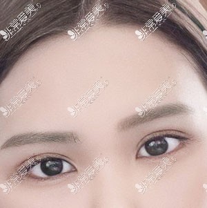 韩国yellow双眼皮照片