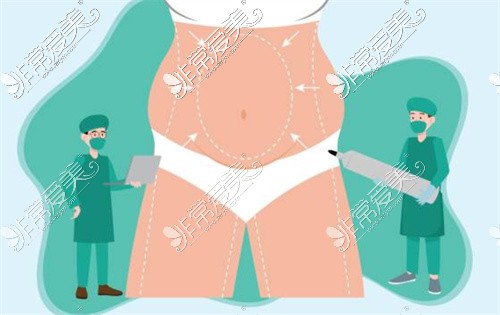 成都禾臣瑞亚医疗美容吸脂示意图 成都禾臣瑞亚医疗美容吸脂示意图