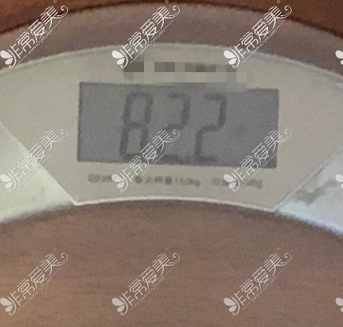 找冯斌吸脂前的体重