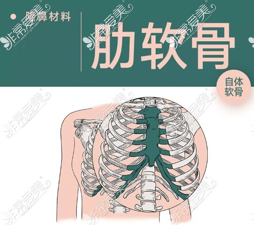 肋软骨隆鼻动画图