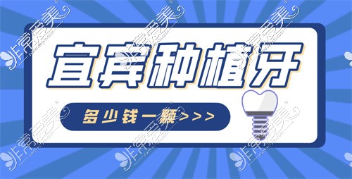 宜宾种植牙多少钱—颗?揭秘宜宾韩国美国瑞士种植体价格!