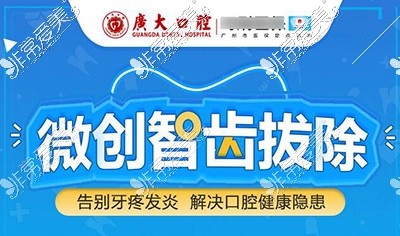 廣州廣大口腔智齒拔除改善